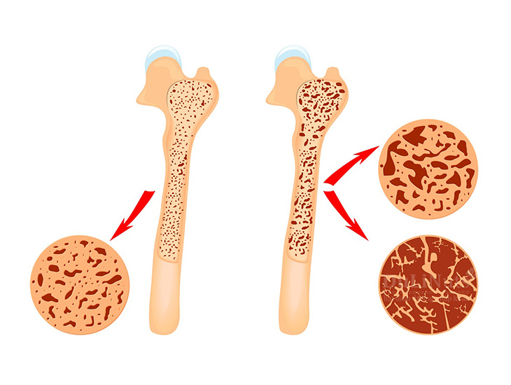 16 lợi ích sức khỏe tuyệt vời của quả óc chó