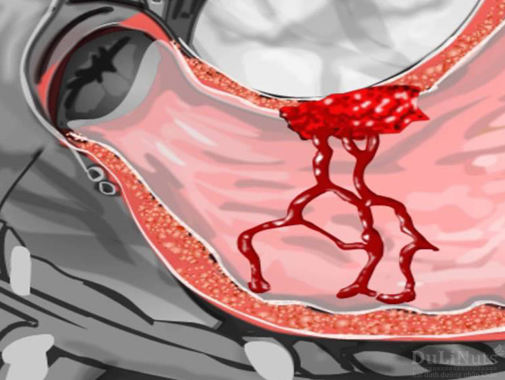 16 lợi ích sức khỏe tuyệt vời của quả óc chó