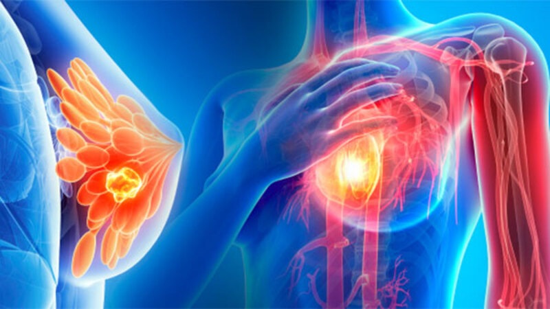 Ngăn ngừa ung thư là một công dụng của omega 3